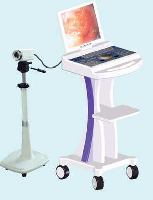 rsd3500 video colposcope