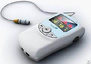 Handheld Etco2 Monitor Palm Co2cgm Patient Monitor