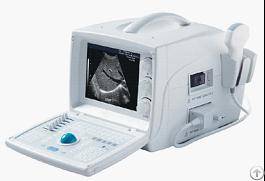 Laptop Ultrasound Scanner Rsd-rp6e Human