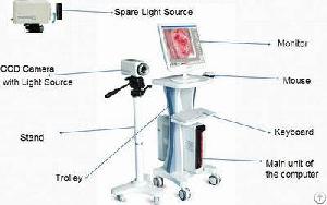 Video Colposcope Rsd3500 Good Reputation In This Line