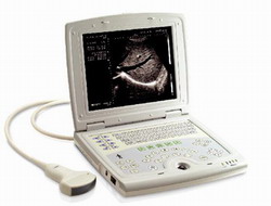 notebook laptop ultrasound scanner rsd rd8b human digital