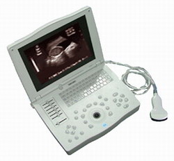 Notebook Ultrasound Scanner Rp6a , Laptop Ultrasound Scanner Rp6a From Ronseda