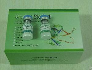 Mouse Anti-human A1bg Monoclonal Antibody