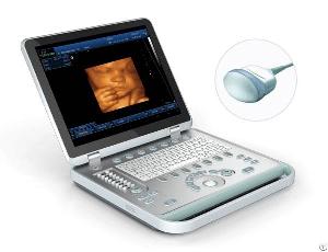 ss 10plus 4d laptop ultrasound scanner