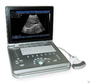 ss 9 pc laptop ultrasound b scanner ultrasoni