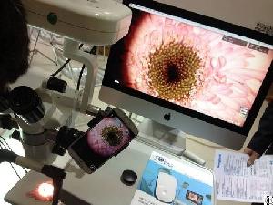 smartphone video adapter recording microscope slit lamp