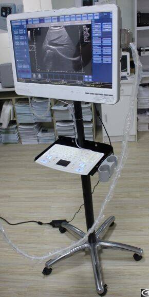 C6 Color Doppler Ultrasound System Touch Screen