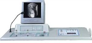 Mm 007 The High Frequency Medical Remote Controlled Diagnostic X-ray System