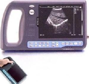 Mm-d-03 Palm Handle Ultrasound Scanner