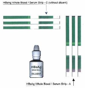 step hbsag blood serum test