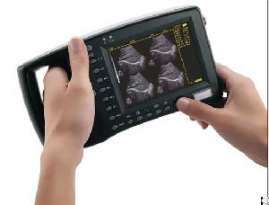 Factory Price Ultrasound Scanner For Sale