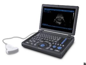 A15 Full Digital Laptop Ultrasound Scanner