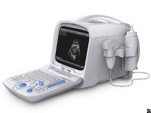 A45 Basic Portable Ultrasound Medical Equipment
