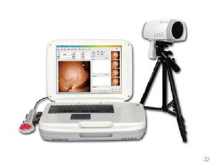 ykd 1004 portable infrared breast examination equipment