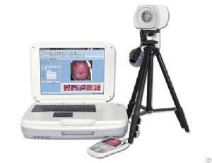 ykd 3004 portable digital colposcope