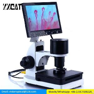 Usb Blood Microcirculation Inspection Zoom Nailfold Capillary Microcirculation Digital Microscope