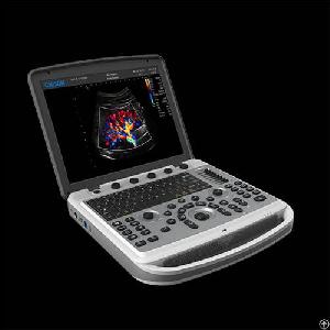 Portable Ultrasound Machine For Vascular Access