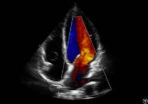 Auto Imt, 4d Ultrasound, Telemedicine, 128 Physical Channel