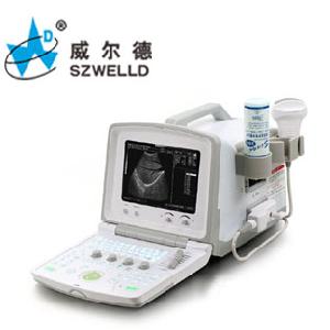 B Mode Diagnostic Ultrasound Scanner