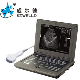 Palm Top Medical Ultrasound