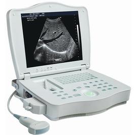 rsd rp6a plus human digital laptop ultrasound scanner