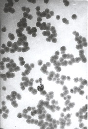 Nanometer Titanium Dioxide Dispersion