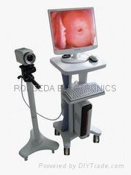 video colposcope ronseda rsd3500