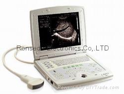 Full Digital Laptop Ultrasound Scanner Rsd-rd8b Vet