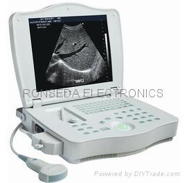 Full Digital Laptop Ultrasound Scanner Rsd-rp6a Plus Human High-quality Images