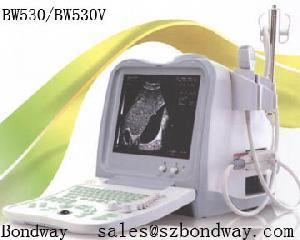 digital ultrasound scanner