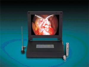 Endoscopy Camera