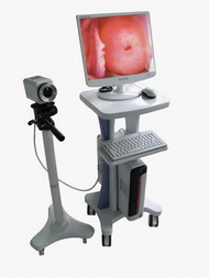 video colposcope rsd 3500 electronics