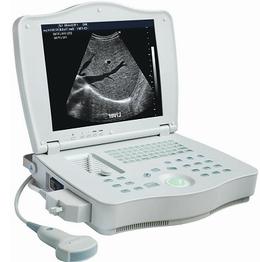 Rsd-rp6a Plus Human Full Digital Laptop Ultrasound Scanner Made In Ronseda