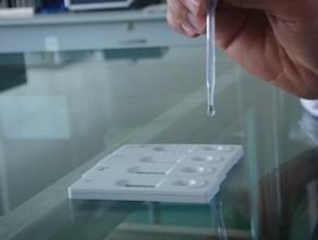 rapid detection schistosomiasis antibodies kit