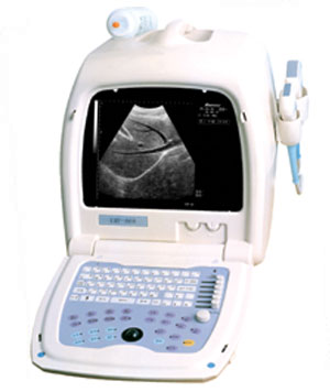 ultrasound scanner osen800