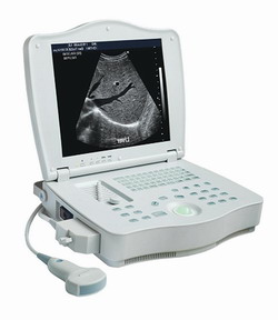 Full Digital Laptop Ultrasound Scanner