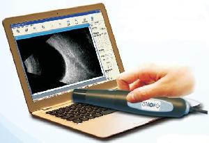 B Scan Ophthalmic Ultrasound