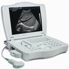 Best-selling Female Product-full Digital Laptop Ultrasound Scanner-ronseda