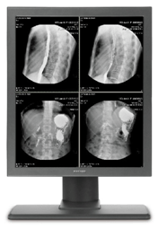 19.6inch 2mp Monochrome Medical Display Monitors