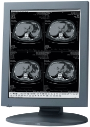 19inch High Bright 1.3megapixel Medical Lcd Display Monitors