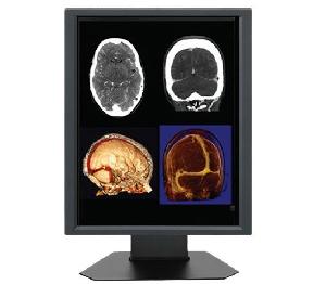 20.1inch 2mp Megapixel Color Lcd Medical Display Monitors