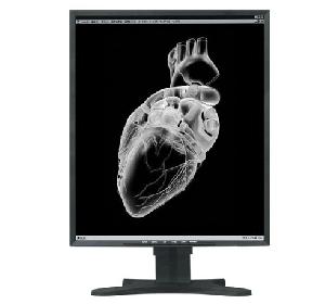 20.8inch 3mp Monochrome Grayscale Lcd Medical Display Monitor