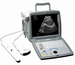 portable ultrasound scanner rsd1001