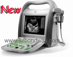Digital Portable Ultrasound Diagnostic System Bw550