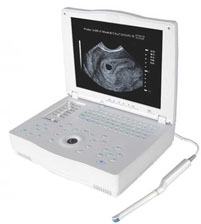 Laptop Ultrasound Scanner Human Use
