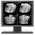 19.6inch 2mp Monochrome Medical Display Monitors