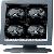 19inch High Bright 1.3megapixel Medical Lcd Display Monitors